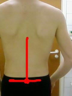 Das Rot makierte ist der bereich wo die schmerzen extrem sind.