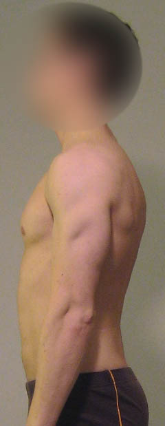 normale Seitenansicht