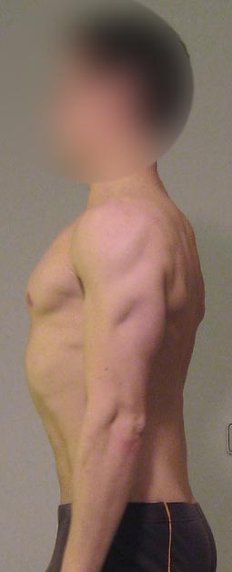 Versuch, "gerade" dazustehen, sieht irgendwie unnatürlich aus