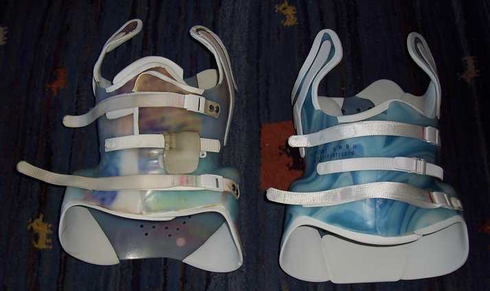 alres und neues Korsett von vorne