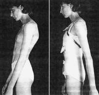 Wirkung eines MKO auf den Körper