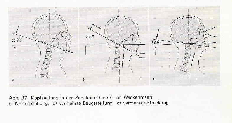 Kopfstellung und HWS-Form.jpg