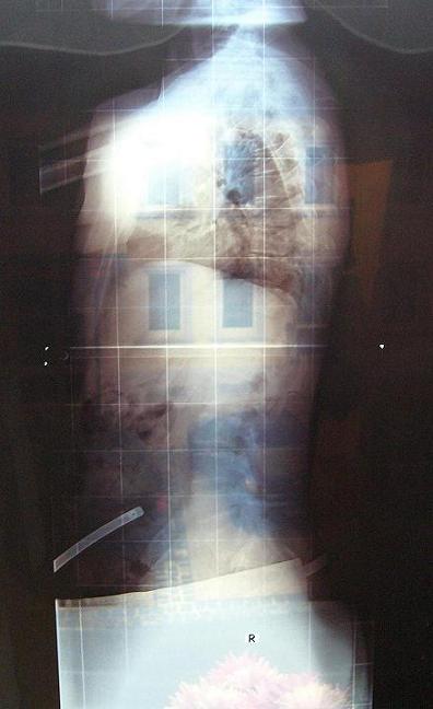 röntgen.jpg