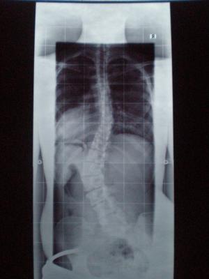th. 36°  lu. 50° ohne Korsett und ohne Erhöhung