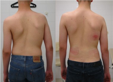 kosmetische veränderung