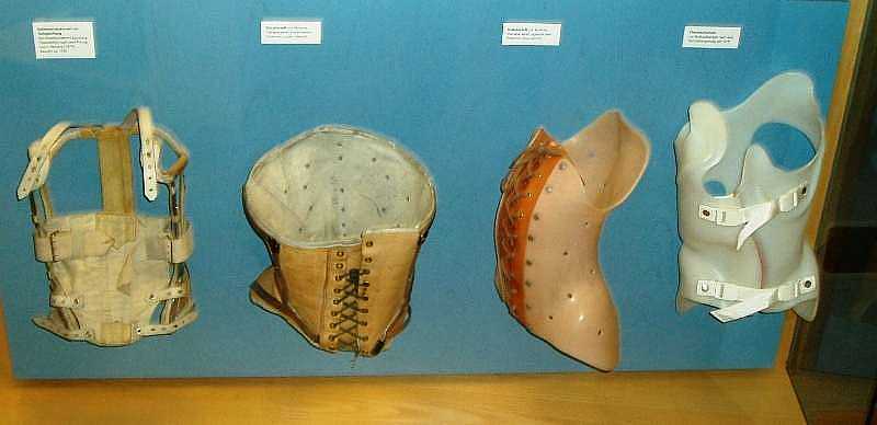 Skoliose-Korsette im Orthopädie-Museum