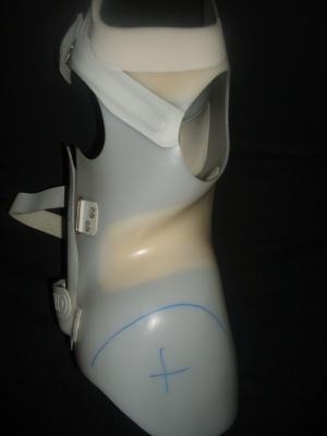 bis zum Strich hätte alles weggemusst, sie konnte mit der Hüfte gar nicht ausweichen