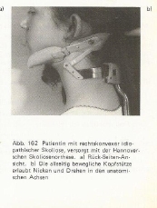 Die Nickachse sind eigene Scharniervernindungen.