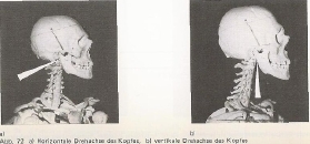 Die beiden obersten Halswirbel ATLAS und DREHER haben ganz unterschiedliche Aufgaben und Bewegungsachsen!