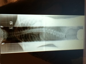 Eins meiner Röntgenbilder