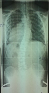 Röntgenbild vom August 2010 bei Dr. Hoffmann