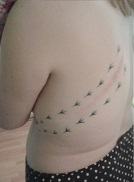 meine verzierte Narbe ;)