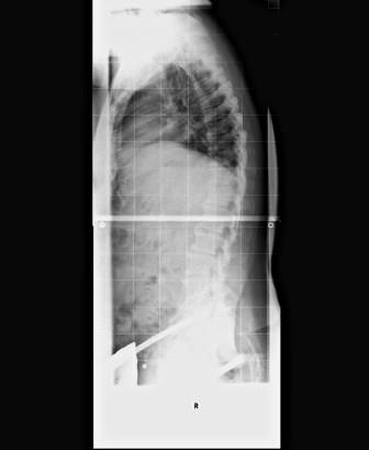 Röntgenbild vom 27.04.2017