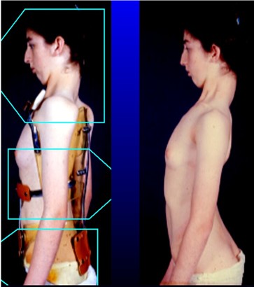 verformung ins schlechte!