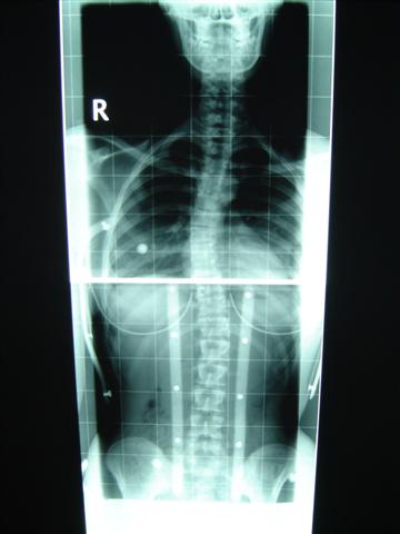 Man beachte mein wunderschön geröntges Gebiss ;)