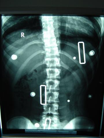 ImNachtkorsett 1.JPG