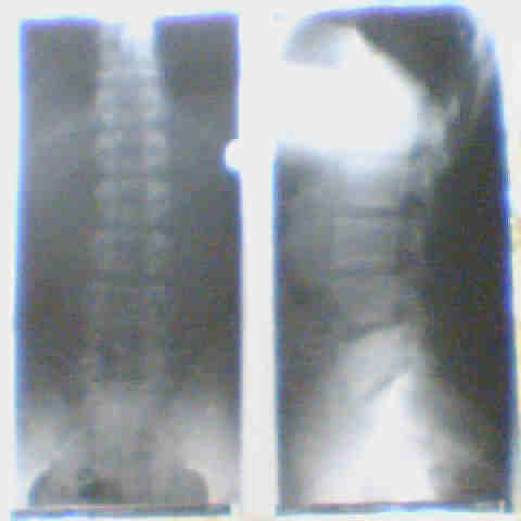 Zwei Röbis von 1998 zum Vergleich