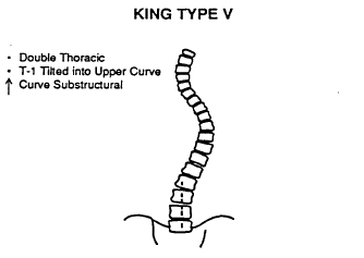 Skoliosemuster King Type V