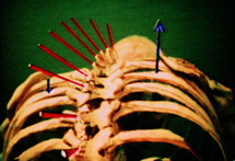 Der linke kleine blaue Pfeil zeigt die schache Seite, der nach oben zeigende blaue Pfeil rechts das "Paket" weil da die Rippen rausgedreht sind.