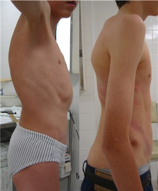 Glockenthorax.jpg