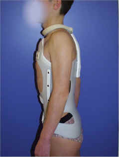 Franz.Anti Scheuermann-corset mit Halsschlinge